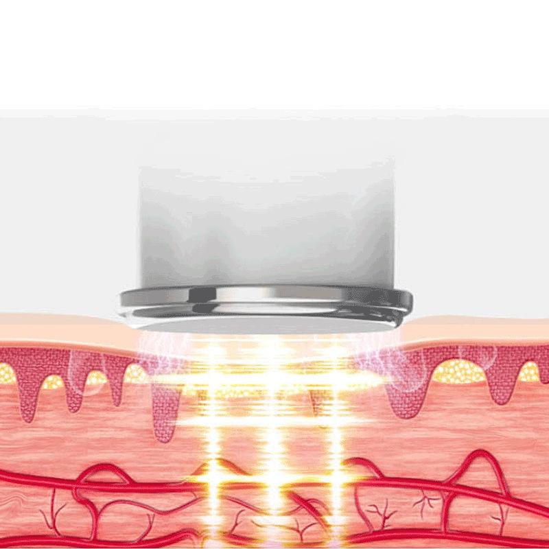 Hot Compress Shoulder & Neck Massager – 4 Ends Model